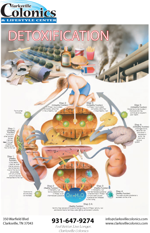 Do You Need To Detox?